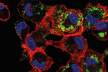 Infected macrophages