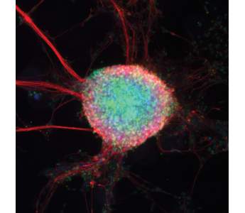 Stem cells. Image: Dr. Jacob Hanna