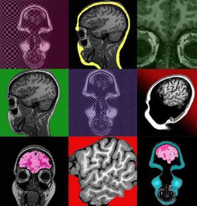 Brain Storm | Hagar Goldberg, Neurobiology