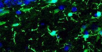 Microglia (bright green) in an adult mouse brain
