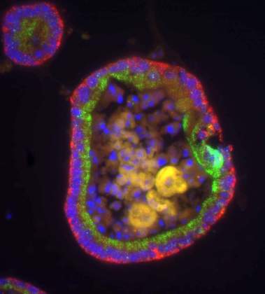 A circular organoid that mimics a cross-section of the gut in the test tube