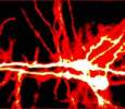 Nerve Cells