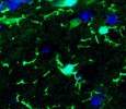 Microglia (bright green) in an adult mouse brain