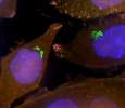 Bacteria (green) inside human pancreatic cancer cells 