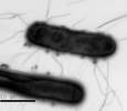 Bacteria defenses against phages