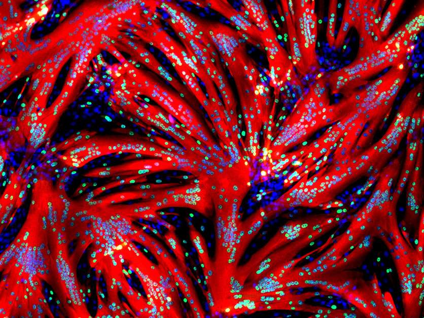 Mouse myoblasts after a 24-hour exposure to a molecule blocking the ERK enzyme. The exposure caused the cells to undergo massive fusion, forming muscle fibers (red) with multiple nuclei (blue) // Dr. Tamar Eigler (Prof. Tzahor's research group)