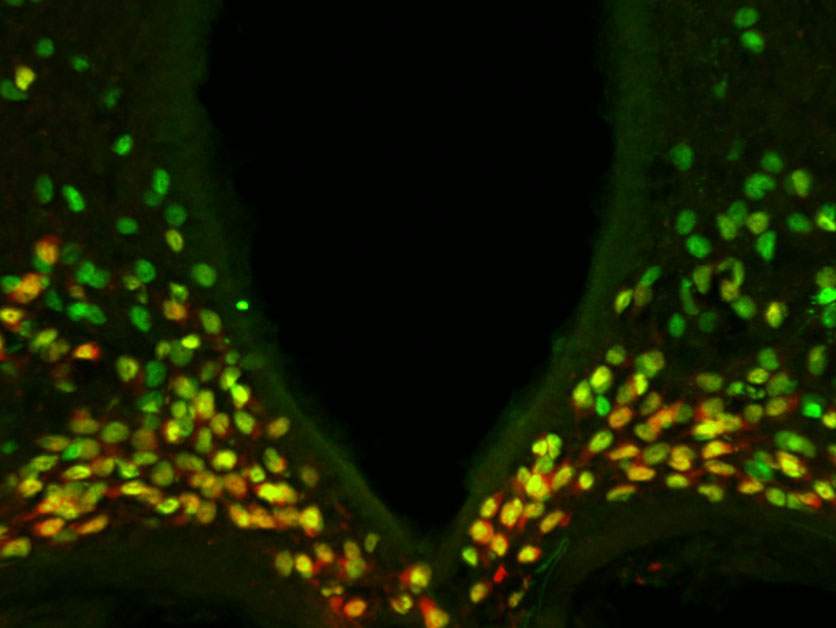 A portion of the mouse hypothalamus reveals that the protein made by the Otp gene (green) is expressed in all the neurons (red) that drive hunger – and the combined color is therefore yellow. It was known that in the developing brain, Otp is needed for the generation of these neurons. The study found that during adulthood, Otp is crucial for causing these neurons to express AgRP, a major hunger-promoting substance