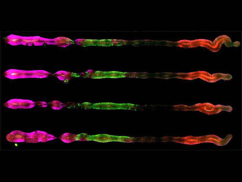 Researchers used color-coded proteins to reveal the identity of the cells in the organoids they produced. In four organoids that simulate the embryo’s central nervous system, the magenta marks proteins associated with the development of the forebrain and the midbrain, the green, the hindbrain and the red, the center of the spinal cord