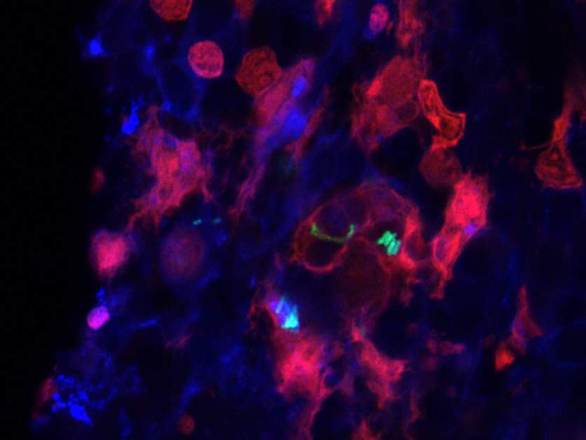 Fluorescence microscopy image of Salmonella (green) engulfed by splenic macrophages (red; blue – cell nuclei)