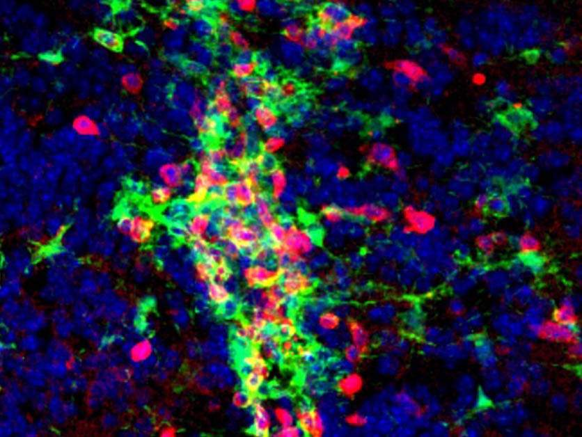 The brain of a mouse with an MS-like disease reveals clusters of microglia (green) and T cells (red)