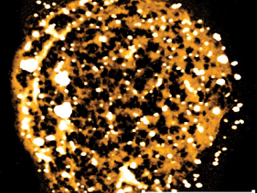 filaments melting in infected red blood cells 