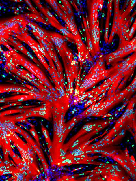 Mouse myoblasts after a 24-hour exposure to a molecule blocking the ERK enzyme. The exposure caused the cells to undergo massive fusion, forming muscle fibers (red) with multiple nuclei (blue) // Dr. Tamar Eigler (Prof. Tzahor's research group)