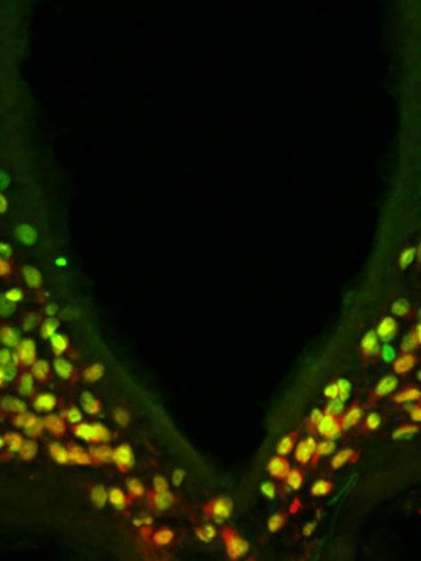 A portion of the mouse hypothalamus reveals that the protein made by the Otp gene (green) is expressed in all the neurons (red) that drive hunger – and the combined color is therefore yellow. It was known that in the developing brain, Otp is needed for the generation of these neurons. The study found that during adulthood, Otp is crucial for causing these neurons to express AgRP, a major hunger-promoting substance