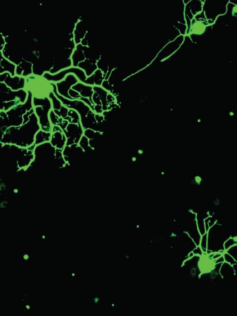 Peripheral sensory neurons in a laboratory dish