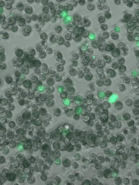 Lung macrophages infected with the human cytomegalovirus. Cells harboring an active infection are in bright green