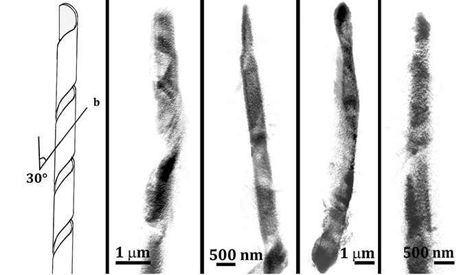 cholesterol crystals 