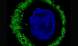 Natural anticancer antibodies (green) bound to a single ovarian tumor cell; the cell’s nucleus is in blue. Viewed with confocal microscopy