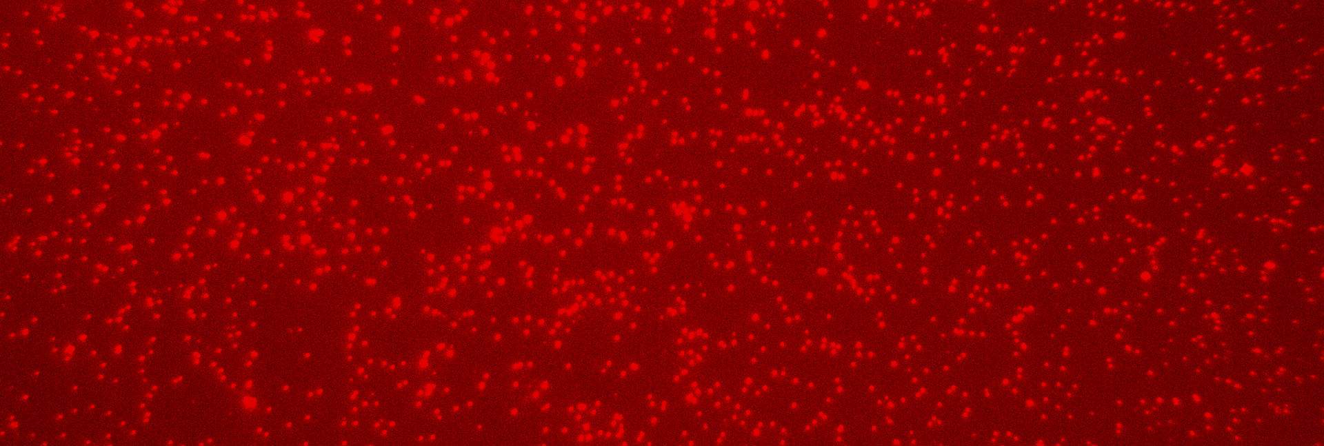 Patterns of epigenetic markers revealed by EPINUC on blood nucleosomes (bright-red dots)