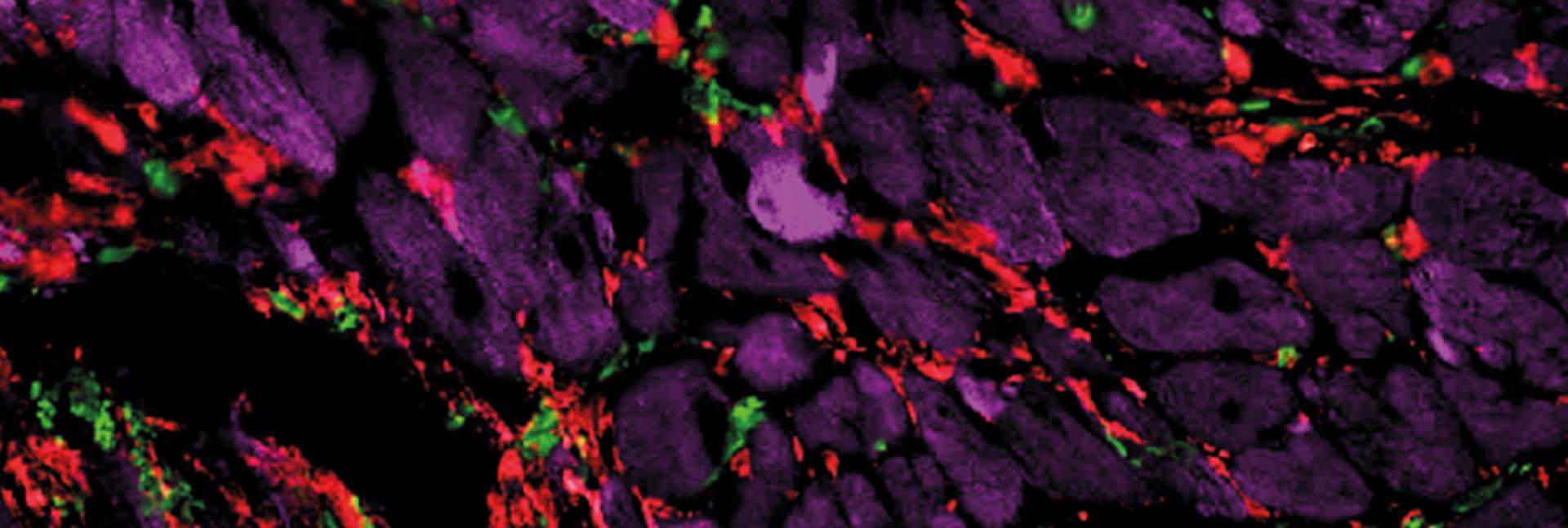 Mouse heart tissue viewed under a microscope