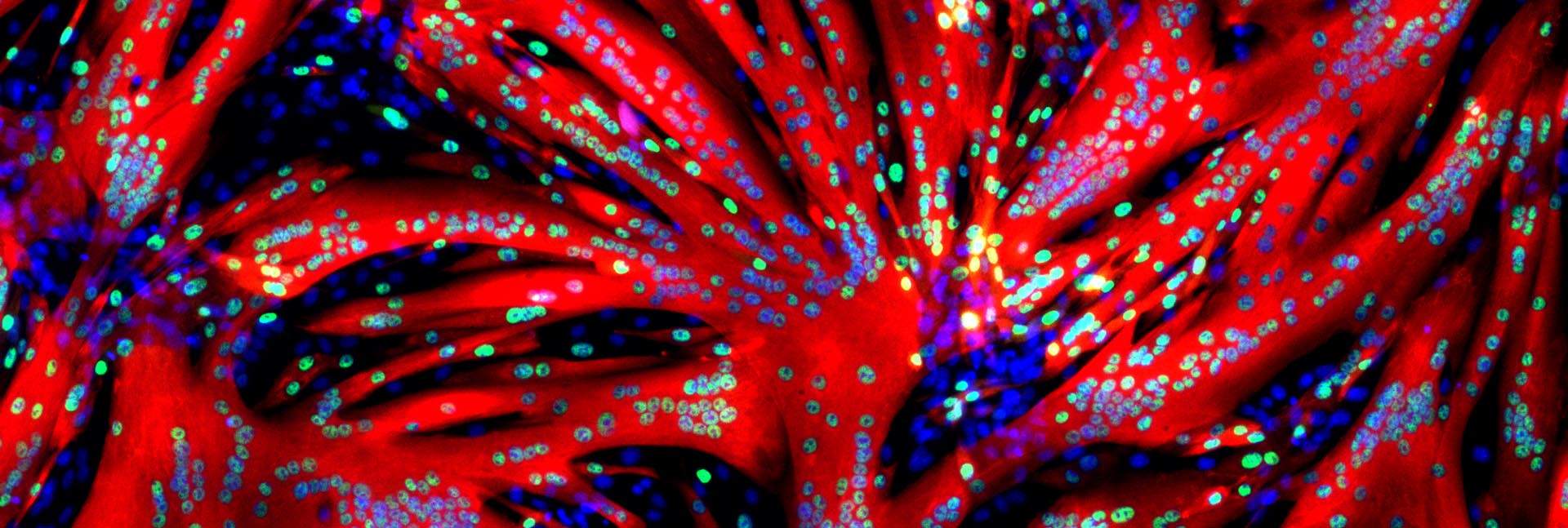 המראה המפתיע שהתגלה מבעד לעינית המיקרוסקופ: תאי גזע של שריר שמקורם בעכברים עברו תהליך מהיר של איחוי ויצירת סיבי שריר (באדום) מרובי גרעינים (הנקודות הכחולות) לאחר שנחשפו במשך 24 שעות למולקולה החוסמת את האנזים ERK // ד"ר תמר איגלר, מעבדת המחקר של פרופ' אלדד צחור
