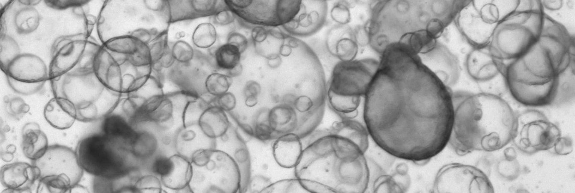 Intestinal organoids grown in the lab from stem cells derived from patients. Each sphere represents one organoid. Photo: Petro Busko, a PhD student in Biton’s lab