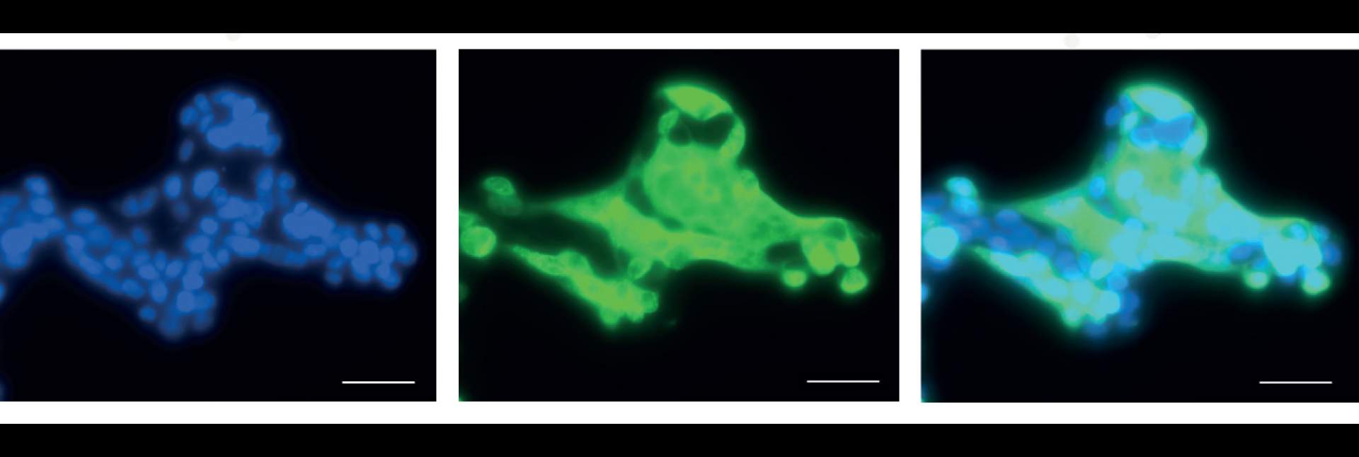 Microscopic image of cultured human lung cells infected with SARS-CoV-2. In green – SARS-CoV-2 staining; In blue – Staining of the cells’ nuclei