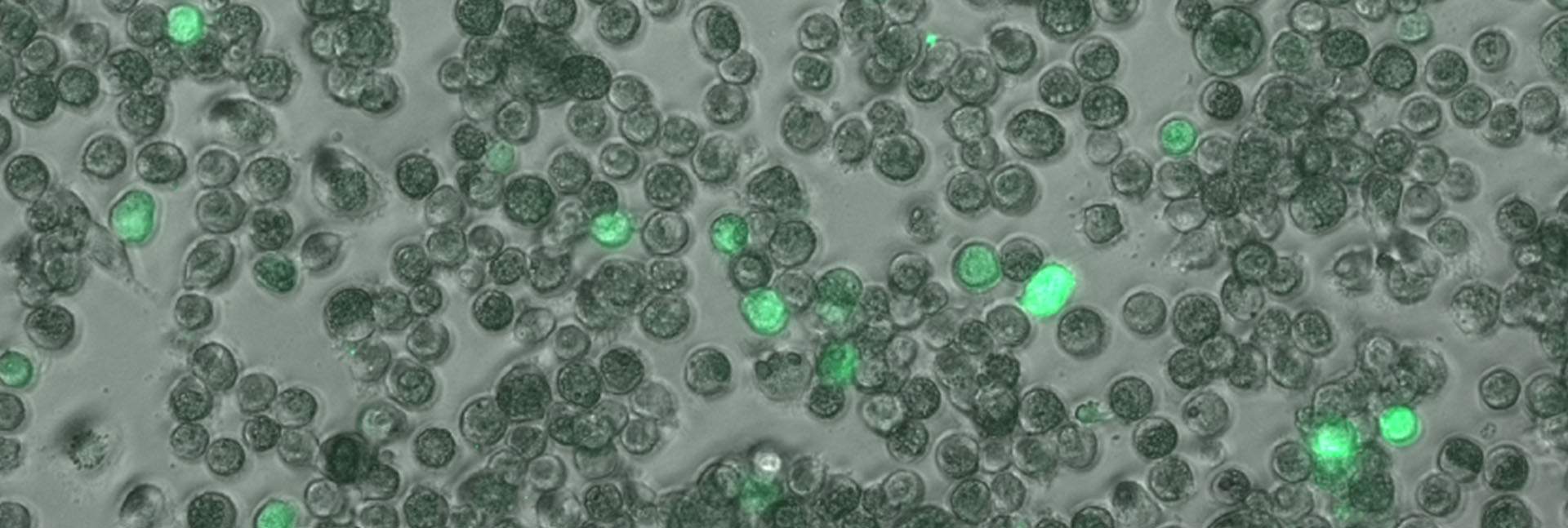 Lung macrophages infected with the human cytomegalovirus. Cells harboring an active infection are in bright green