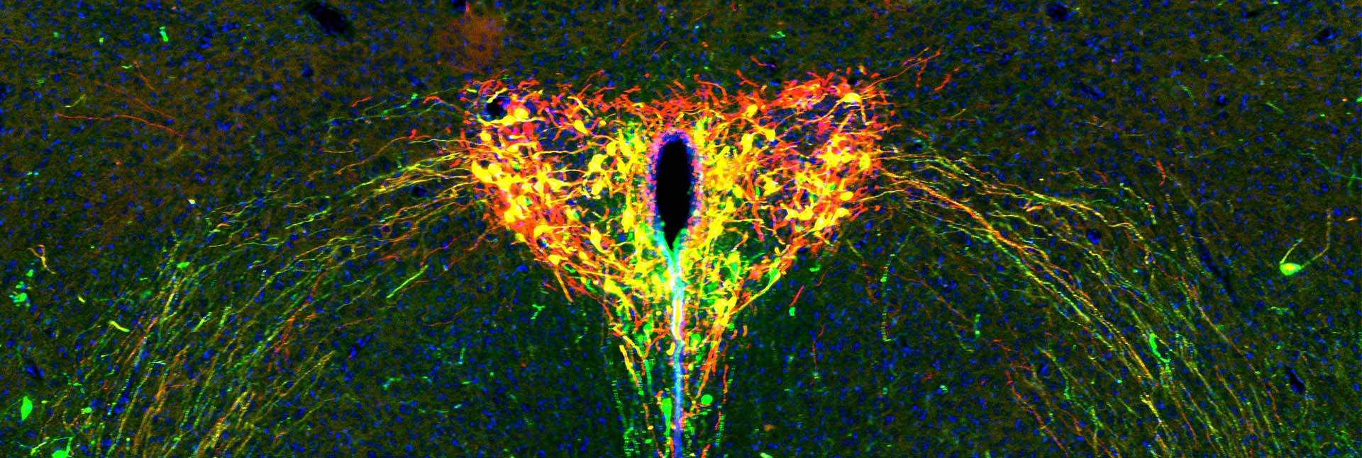 The developing brain of a two-week-old mouse pup under the microscope. The oxytocin system appears in green, the light-sensitive protein in red and cells that carry both show up in yellow. Cell nuclei are in blue