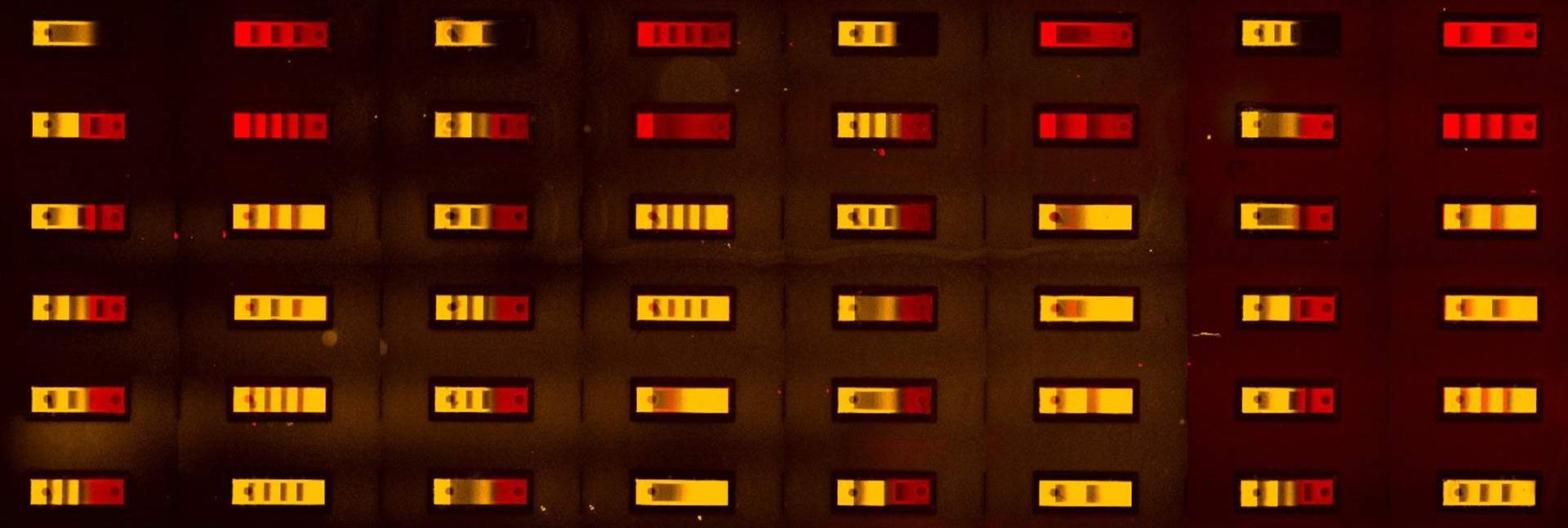 A fluorescent microscope image of the biochip with its numerous minuscule compartments, each presenting a different antigen – making it possible to simultaneously test the interactions of all these antigens with a human antibody