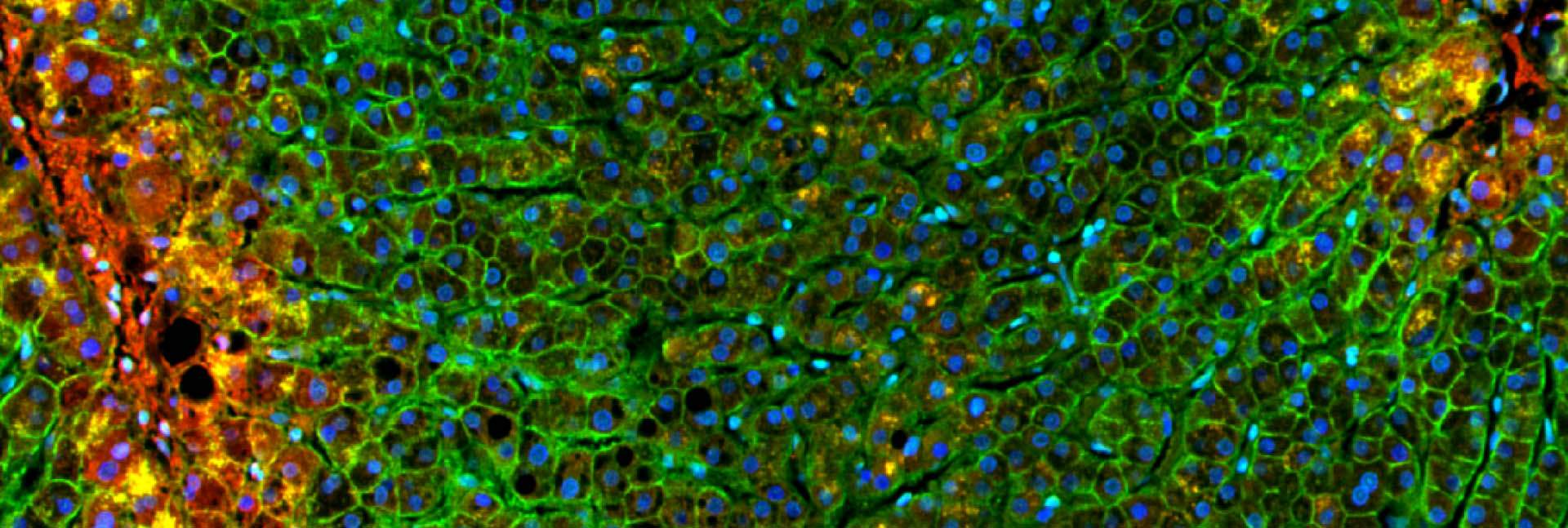 Human liver