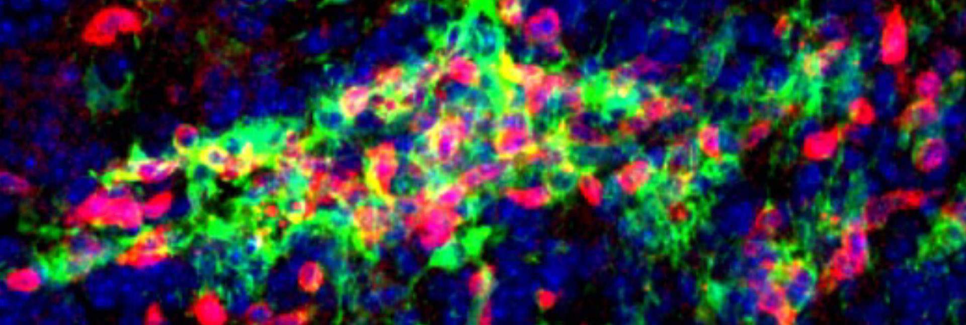 The brain of a mouse with an MS-like disease reveals clusters of microglia (green) and T cells (red)