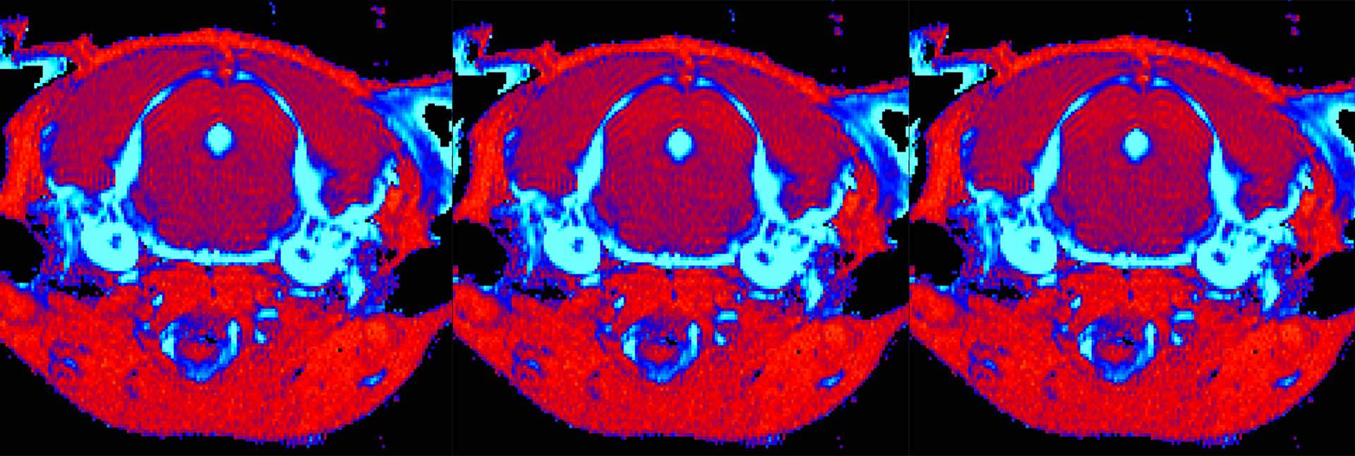 MRI brain scans of mice with Gaucher disease Type III. The scan of a mouse that received the new treatment (left) shows a significant reduction in tissue inflammation (blue) compared to an untreated mouse (right)