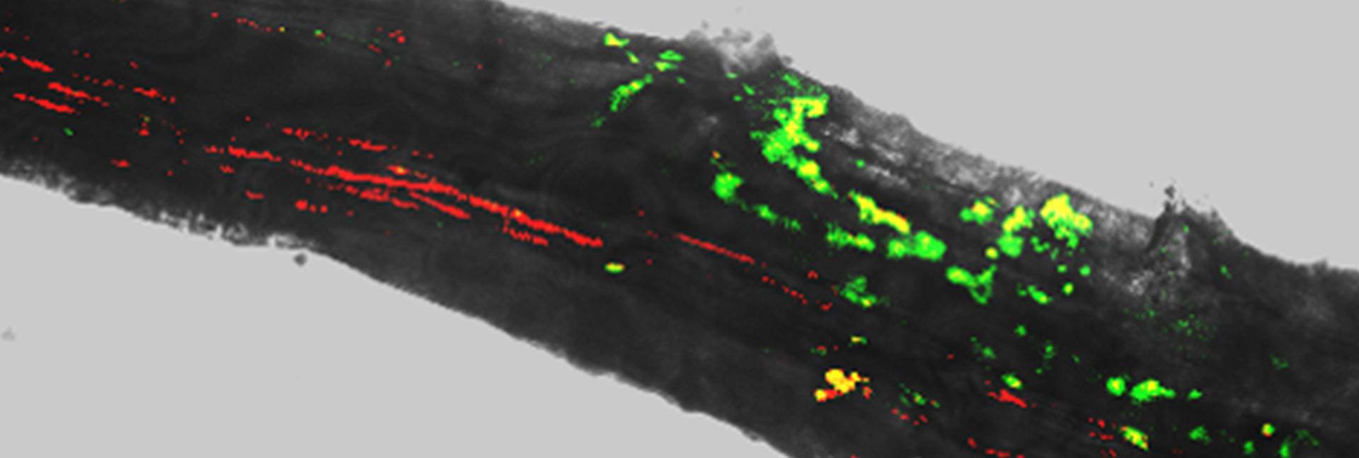 Tree roots recruit beneficial bacteria during drought. Fluorescence and bright-field imaging reveals that during drought (left) a tree root is more densely colonized by two beneficial bacteria (green and red) than after irrigation (right)