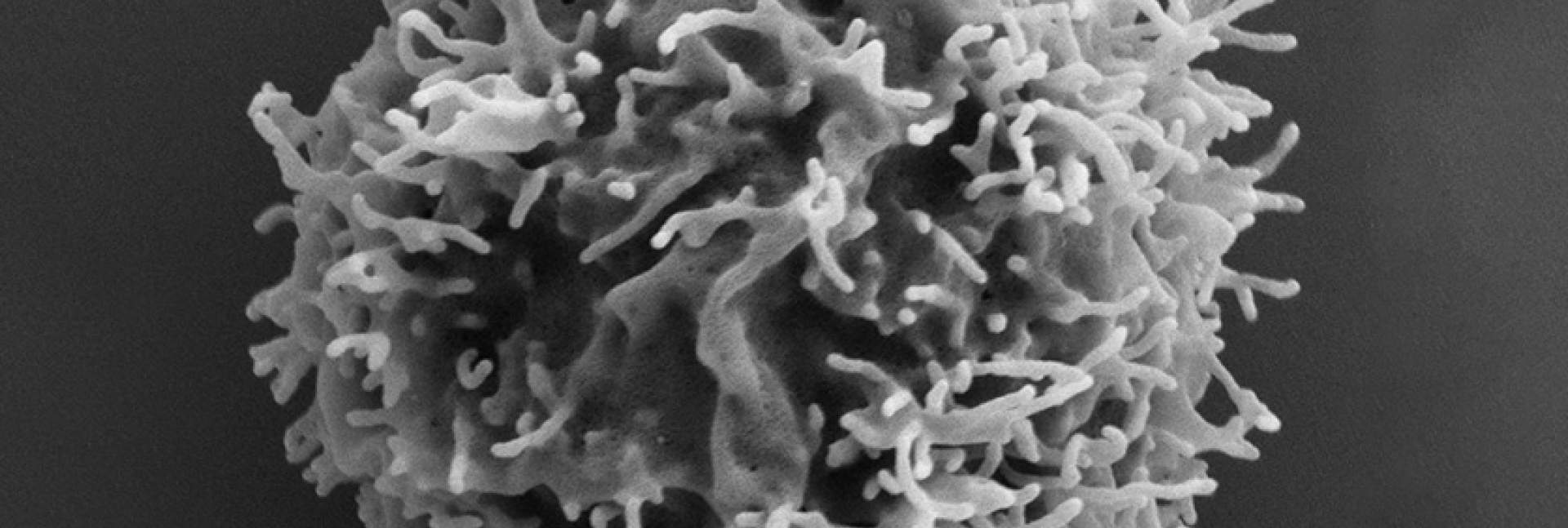 Microvilli on a T cell surface, viewed with a scanning electron microscope