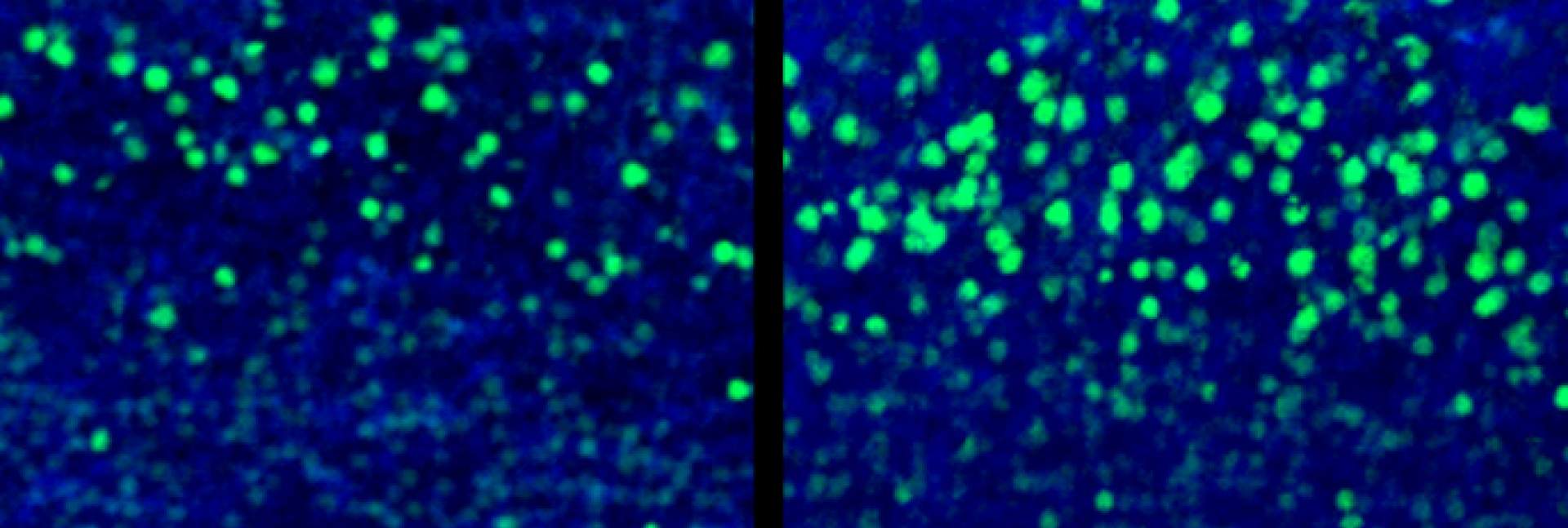 חתך מקליפת המוח של עובר עכבר בן 18 יום מקבוצת הביקורת (שמאל) ומהקבוצה שנחשפה לתגובת המערכת החיסונית של האם (ימין). בירוק – תאי השכבה החמישית שבקליפת המוח (CTIP2), המיוצרים בעודף בקבוצה שנחשפה לתגובה החיסונית. קנה מידה: 20 מיקרומטר