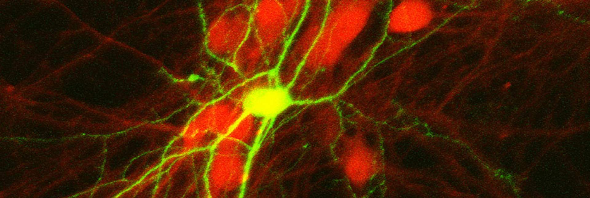Inhibitory mouse neurons – viewed under a microscope