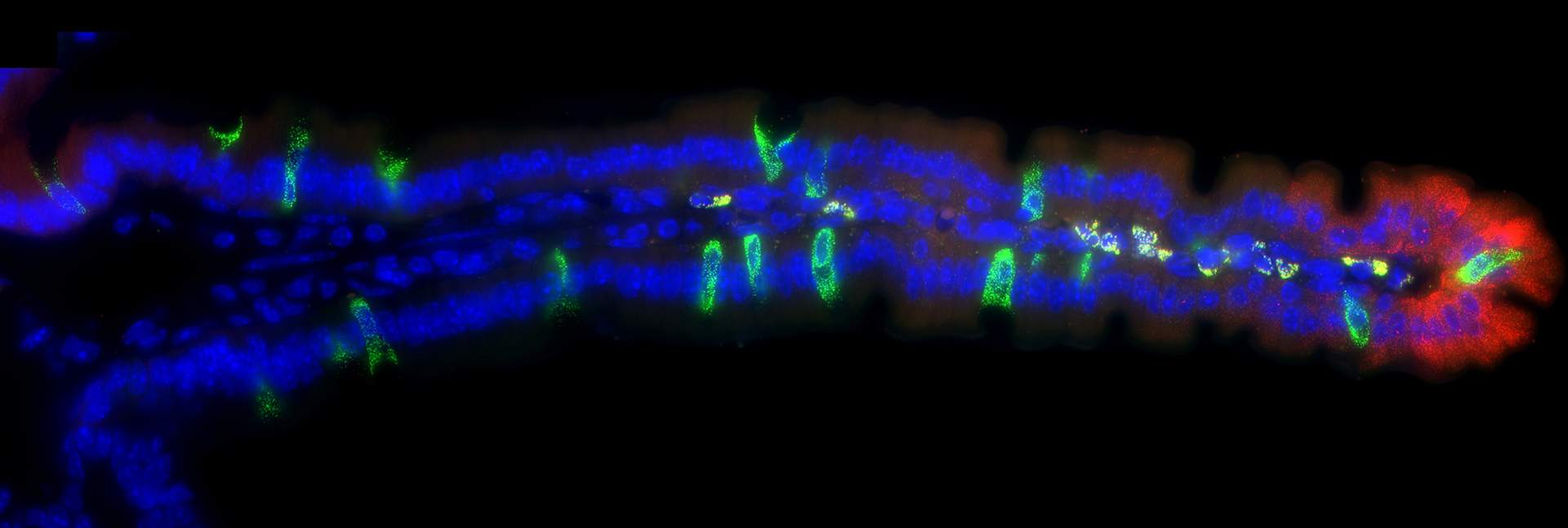 Fluorescence microscopy image of genes (red and green) that are expressed in particular zones along the villus (blue – cells’ nuclei)